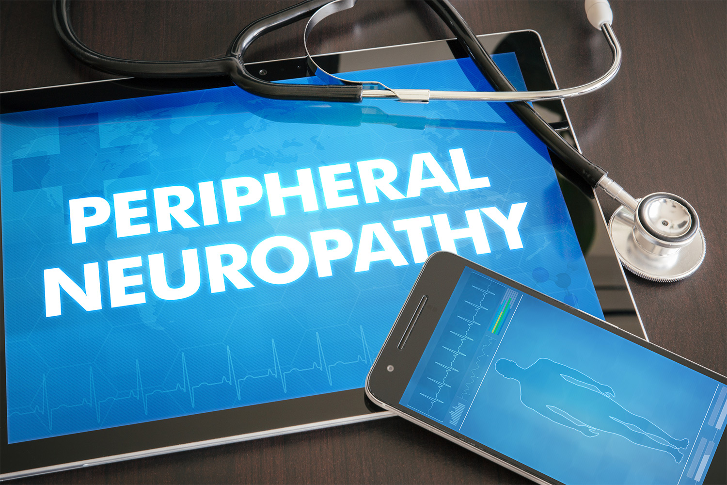 VA Rating for Peripheral Neuropathy