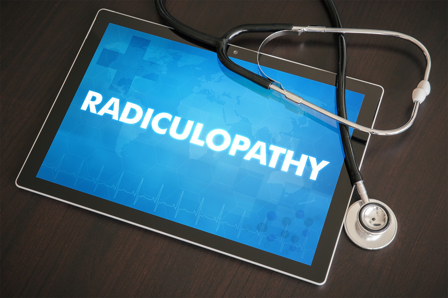 Radiculopathy VA Rating What Does It Mean Berry Law