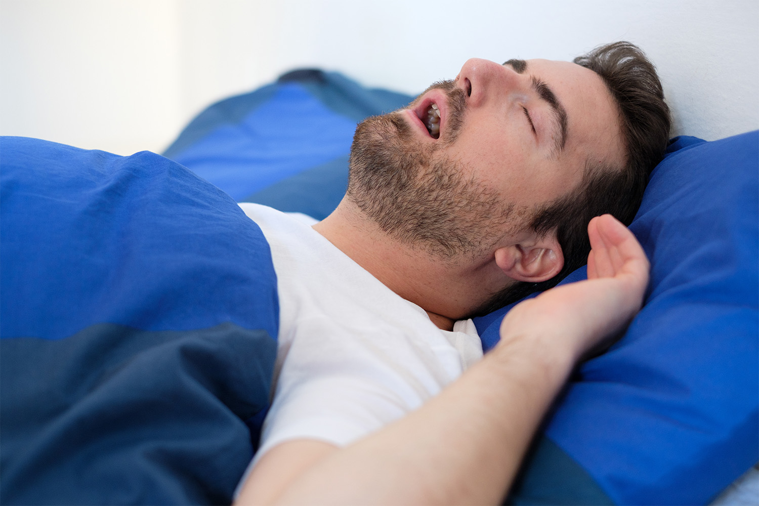 Can Your Sleep Apnea be Secondary to Your TBI?
