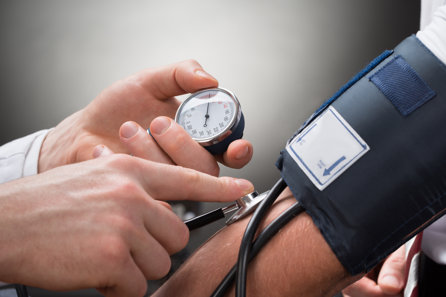 VA’s Decision on Hypertension & Agent Orange Exposure